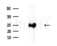 Bcl-2 Antibody - Western blot analysis of extracts from HepG2 cells(heat-shock treatment), using Bcl-2 Antibody at 1/1000 dilution.
