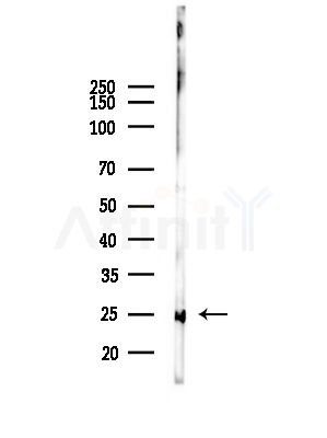 Bcl-2 Antibody - Western blot analysis of lysates from HepG2 cells(heat-shock,45min treatment), using Bcl-2 Antibody at 1/1000 dilution.