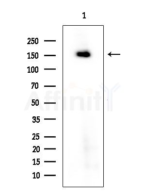 Bcr Antibody - Western blot analysis of extracts from Rat testis, using Bcr Antibody at 1/1000 dilution.
