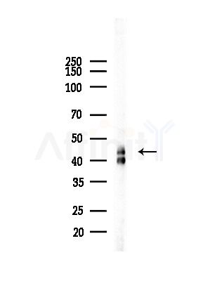 Vitamin D Receptor Antibody - Western blot analysis of lysates from COLO205 cells(heat-shock,45min treatment), using Vitamin D Receptor Antibody at 1/1000 dilution.
