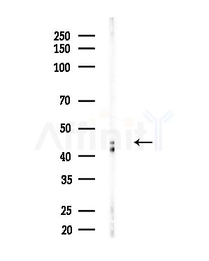 Vitamin D Receptor Antibody - Western blot analysis of lysates from Hela cells(heat-shock,45min treatment), using Vitamin D Receptor Antibody at 1/1000 dilution.