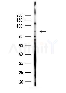 VAV1 Antibody - Western blot analysis of lysates from HUVEC cells(UV,30min treatment), using VAV1 Antibody at 1/1000 dilution.