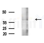 RPA32/RPA2 Antibody - Western blot analysis of extracts from A375 cells(heat-shock,45min treatment), using RPA32/RPA2 Antibody at 1/1000 dilution.