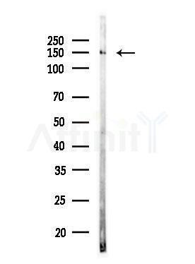 PLCG1 Antibody - Western blot analysis of lysates from COLO205 cells(UV,30min treatment), using PLCG1 Antibody at 1/1000 dilution.