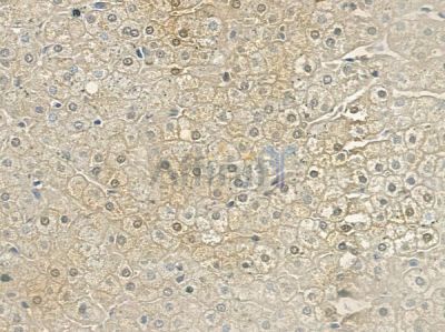 ELK1 Antibody - AF6212 at 1/100 staining human normal liver tissue by IHC-P.