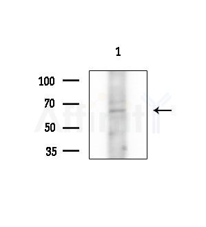 Synaptotagmin 1/2 Antibody - Western blot analysis of extracts from B16F10-LUC cells(LPS 4h treatment), using Synaptotagmin 1/2 Antibody at 1/1000 dilution.
