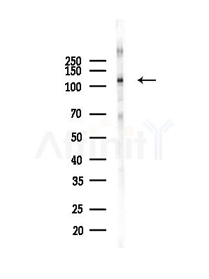 CBL Antibody - Western blot analysis of lysates from COLO205 cells(heat-shock,45min treatment), using CBL Antibody at 1/1000 dilution.