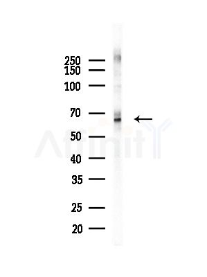 SHP1 Antibody - Western blot analysis of lysates from COLO205 cells(heat-shock,45min treatment), using SHP1 Antibody at 1/1000 dilution.