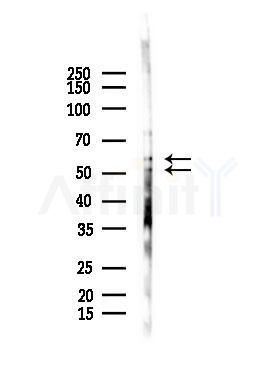 SHC Antibody - Western blot analysis of lysates from A375 cells(starvation,24h treatment), using SHC Antibody at 1/1000 dilution.