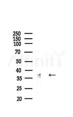 MARCKS Antibody - Western blot analysis of lysates from Mouse liver, using MARCKS Antibody at 1/1000 dilution.