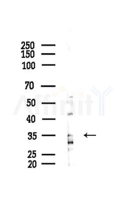 MARCKS Antibody - Western blot analysis of lysates from COLO205 cells(heat-shock,45min treatment), using MARCKS Antibody at 1/1000 dilution.