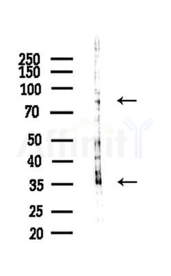 MARCKS Antibody - Western blot analysis of lysates from A375 cells(heat-shock treatment), using MARCKS Antibody at 1/1000 dilution.