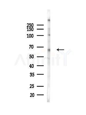 CDC25B Antibody - Western blot analysis of lysates from COLO205 cells(heat-shock,45min treatment), using CDC25B Antibody at 1/1000 dilution.
