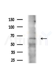 CDC25B Antibody - Western blot analysis of extracts from COLO205 cells(heat-shock,45min treatment), using CDC25B Antibody at 1/1000 dilution.