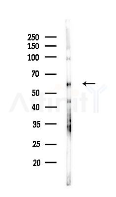 CDC25C Antibody - Western blot analysis of lysates from COLO205 cells(UV,30min treatment), using CDC25C Antibody at 1/1000 dilution.