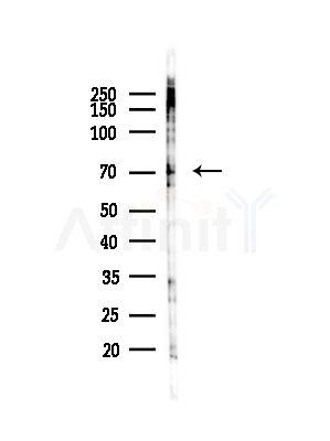 NF2 / Merlin Antibody - Western blot analysis of lysates from COS-7 cells(heat-shock,45min treatment), using NF2 / Merlin Antibody at 1/1000 dilution.