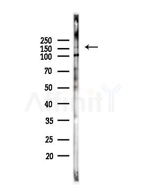 CD130/gp130 Antibody - Western blot analysis of lysates from PC12 cells(heat-shock,45min treatment), using CD130/gp130 Antibody at 1/1000 dilution.