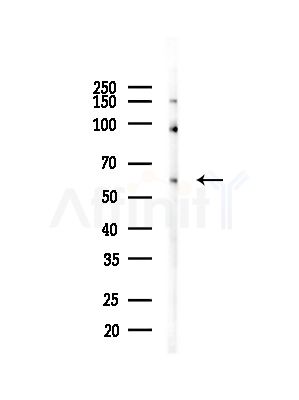 MAP3K8/COT Antibody - Western blot analysis of lysates from COLO205 cells(heat-shock,45min treatment), using MAP3K8/COT Antibody at 1/1000 dilution.