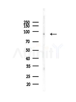 STAT5A Antibody - Western blot analysis of lysates from COLO205 cells(heat-shock,45min treatment), using STAT5A Antibody at 1/1000 dilution.
