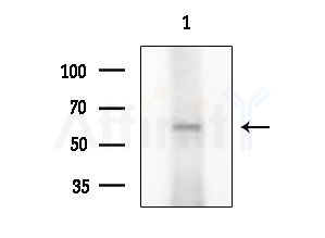 JNK1/2/3 Antibody - Western blot analysis of extracts from K562 cells
(heat-shock treatment), using JNK1/2/3 Antibody at 1/1000 dilution.