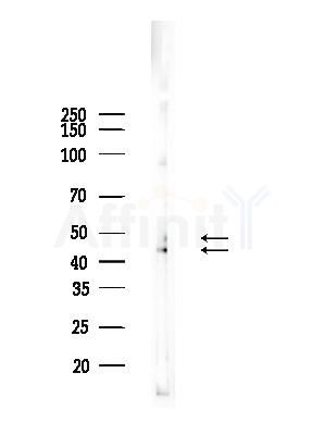 JNK1/2/3 Antibody - Western blot analysis of lysates from K562 cells(heat-shock,45min treatment), using JNK1/2/3 Antibody at 1/1000 dilution.