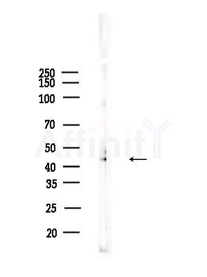 JNK1/2/3 Antibody - Western blot analysis of lysates from K562 cells(heat-shock,45min treatment), using JNK1/2/3 Antibody at 1/1000 dilution.