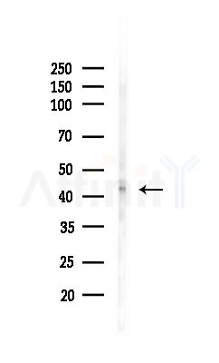SOX9 Antibody - Western blot analysis of lysates from MCF7 cells(heat-shock,45min treatment), using SOX9 Antibody at 1/1000 dilution.