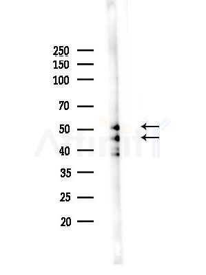 GSK3 alpha/ beta Antibody - Western blot analysis of lysates from Hela cells(heat-shock,45min treatment), using GSK3 alpha/ beta Antibody at 1/1000 dilution.