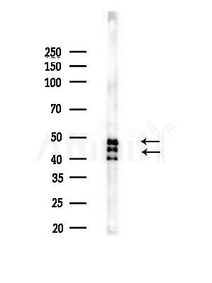 GSK3 alpha/ beta Antibody - Western blot analysis of lysates from LoVo cells(heat-shock, 45min treatment), using GSK3 alpha/ beta Antibody at 1/1000 dilution.