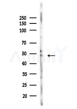 CCR5 Antibody - Western blot analysis of lysates from HUVEC cells(UV,30min treatment), using CCR5 Antibody at 1/1000 dilution.