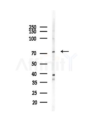 LIMK1/2 Antibody - Western blot analysis of lysates from COLO205 cells(heat-shock,45min treatment), using LIMK1/2 Antibody at 1/1000 dilution.