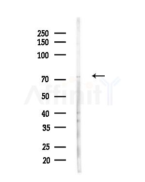 LIMK1/2 Antibody - Western blot analysis of lysates from Hela cells(heat-shock,45min treatment), using LIMK1/2 Antibody at 1/1000 dilution.