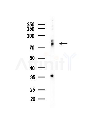 LIMK2 Antibody - Western blot analysis of lysates from COLO205 cells(heat-shock,45min treatment), using LIMK2 Antibody at 1/1000 dilution.