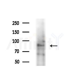 Ataxin 1 Antibody - Western blot analysis of extracts from COLO205 cells(heat-shock,45min treatment), using Ataxin 1 Antibody at 1/1000 dilution.