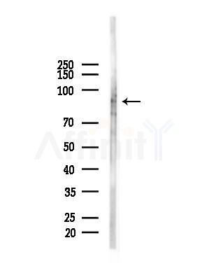 Ataxin 1 Antibody - Western blot analysis of lysates from COLO205 cells(heat-shock,45min treatment), using Ataxin 1 Antibody at 1/1000 dilution.