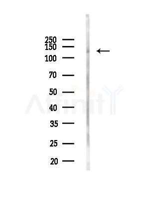 p130 Cas Antibody - Western blot analysis of lysates from EC304 cells(heat-shock,45min treatment), using p130 Cas Antibody at 1/1000 dilution.