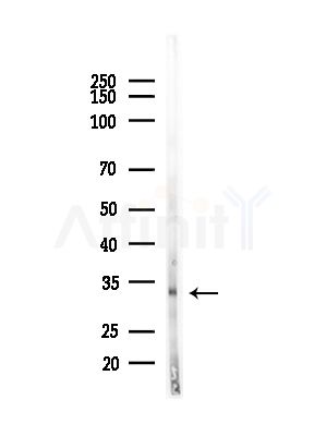 CDK5 Antibody - Western blot analysis of lysates from B16F10-LUC cells(starvation,24h treatment), using CDK5 Antibody at 1/1000 dilution.