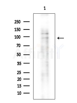 HSL Antibody - Western blot analysis of extracts from Mouse brain, using HSL Antibody at 1/1000 dilution.