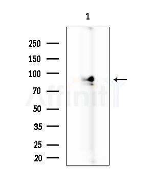 HSL Antibody - Western blot analysis of extracts from HUVEC cells, using HSL Antibody at 1/1000 dilution.