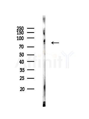 HSL Antibody - Western blot analysis of lysates from HUVEC cells, using HSL Antibody at 1/1000 dilution.