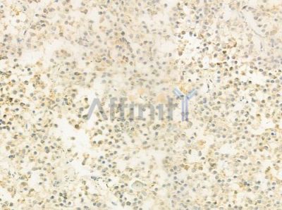 pan-FOXO1/3/4 Antibody - AF6419 at 1/100 staining human pituitary adenoma by IHC-P.