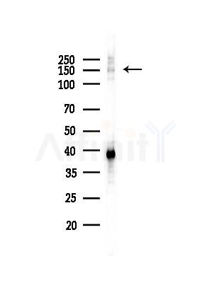 NFAT4 Antibody - Western blot analysis of lysates from EC304 cells(heat-shock,45min treatment), using NFAT4 Antibody at 1/1000 dilution.