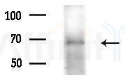 AMPK alpha Antibody - Western blot analysis of extracts from COLO205 cells(heat-shock treatment), using AMPK alpha Antibody at 1/1000 dilution.