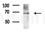 G3BP-1 Antibody - Western blot analysis of extracts from 3T3-L1 cells
(heat-shock treatment), using G3BP-1 Antibody at 1/1000 dilution.