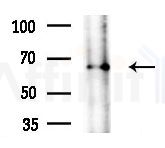 G3BP-1 Antibody - Western blot analysis of extracts from B16F10-LUC cells
(LPS 4h treatment), using G3BP-1 Antibody at 1/1000 dilution.