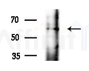 G3BP-1 Antibody - Western blot analysis of extracts from Mouse liver, using G3BP-1 Antibody at 1/1000 dilution.