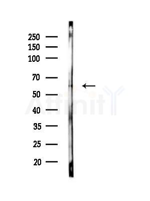G3BP-1 Antibody - Western blot analysis of lysates from Mouse liver, using G3BP-1 Antibody at 1/1000 dilution.