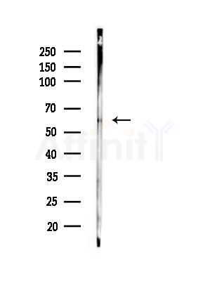 G3BP-1 Antibody - Western blot analysis of lysates from Rat brain, using G3BP-1 Antibody at 1/1000 dilution.