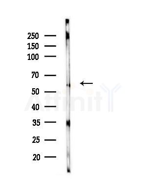 G3BP-1 Antibody - Western blot analysis of lysates from B16F10-LUC cells(LPS,4h treatment), using G3BP-1 Antibody at 1/1000 dilution.