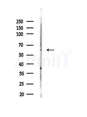 G3BP-1 Antibody - Western blot analysis of lysates from 3T3-L1 cells(heat-shock, 45min treatment), using G3BP-1 Antibody at 1/1000 dilution.